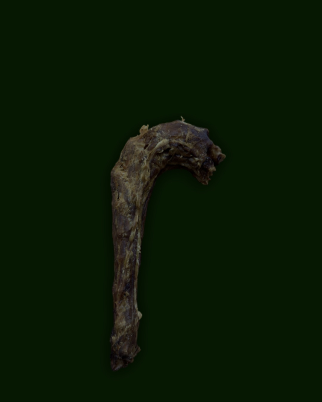 Turkey Neck